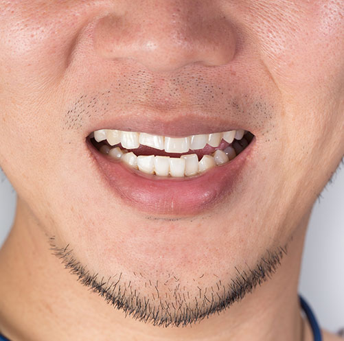Orthodontics | Core Dental | General & Family Dentist | Downtown Calgary