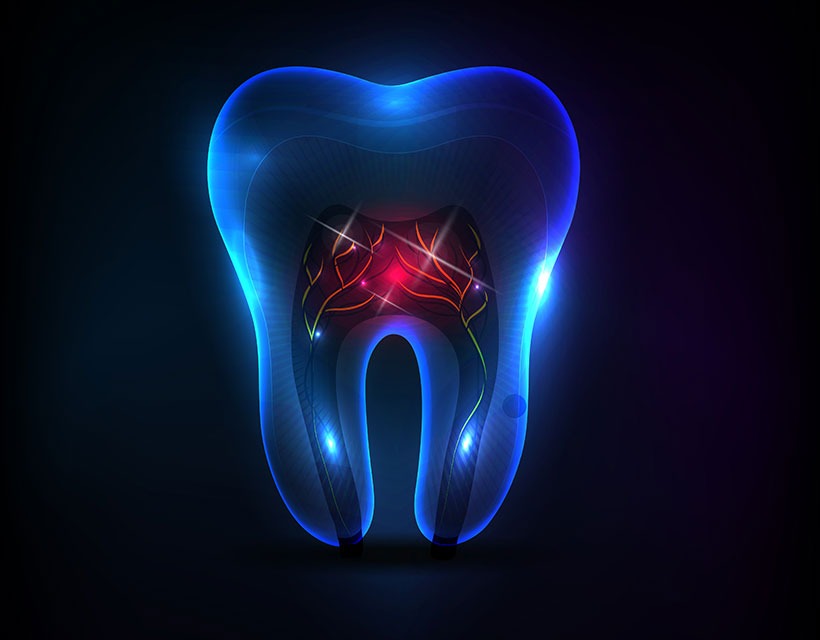 Root Canal Therapy | Core Dental | General & Family Dentist | Downtown Calgary